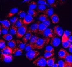 TRPM7 Antibody - Azide and BSA Free, Novus Biologicals:Antibodies:Primary